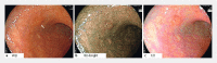 Fig. 1