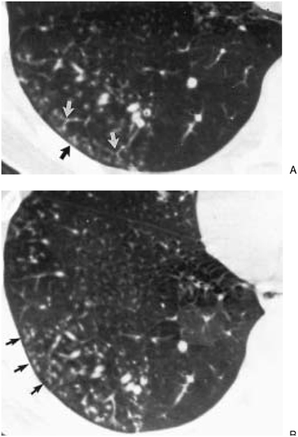 [Table/Fig-3]: