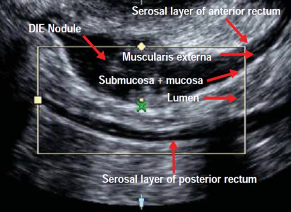 Fig. 5a