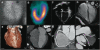 Fig. (2)