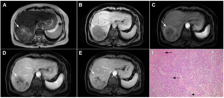 Figure 20