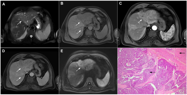 Figure 19