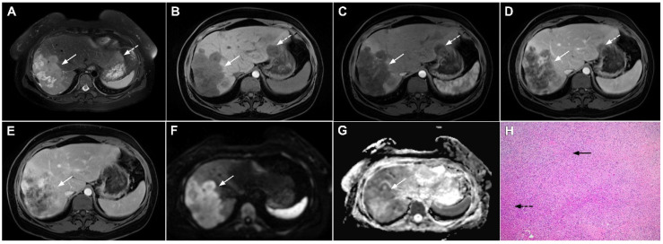 Figure 21