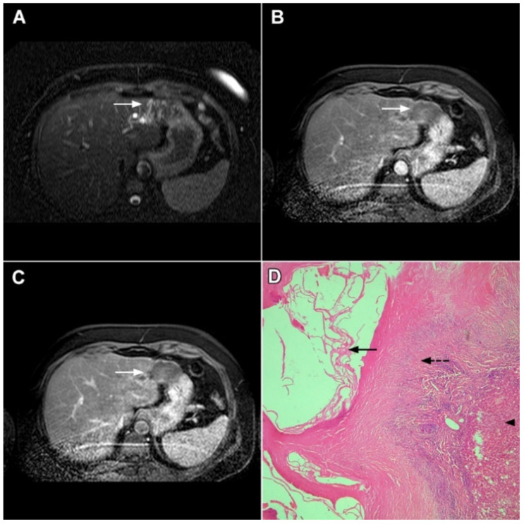 Figure 14