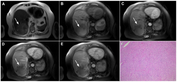 Figure 18