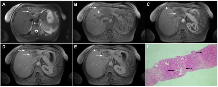 Figure 22