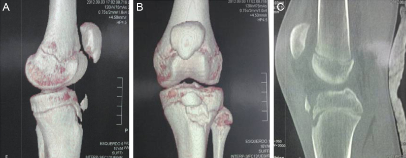 Fig. 2