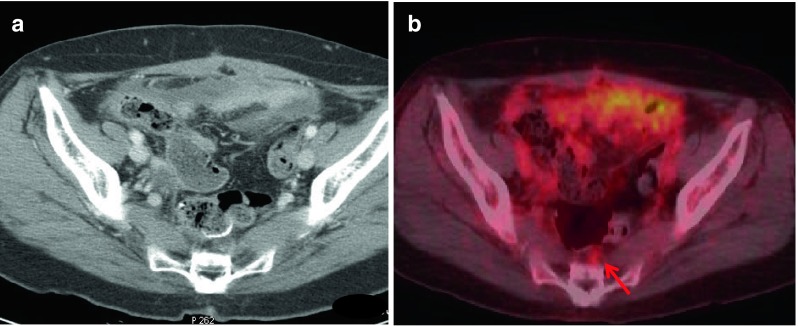 Fig. 1