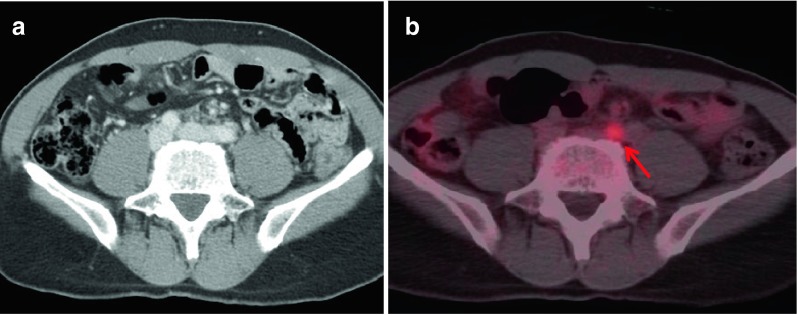 Fig. 2