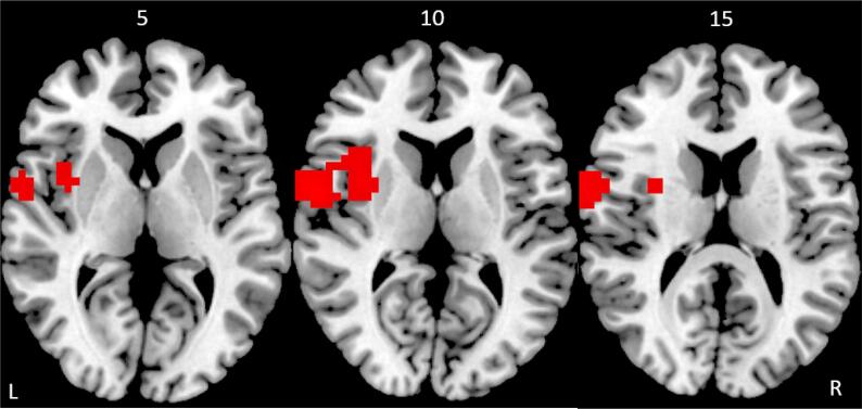 Fig. 2