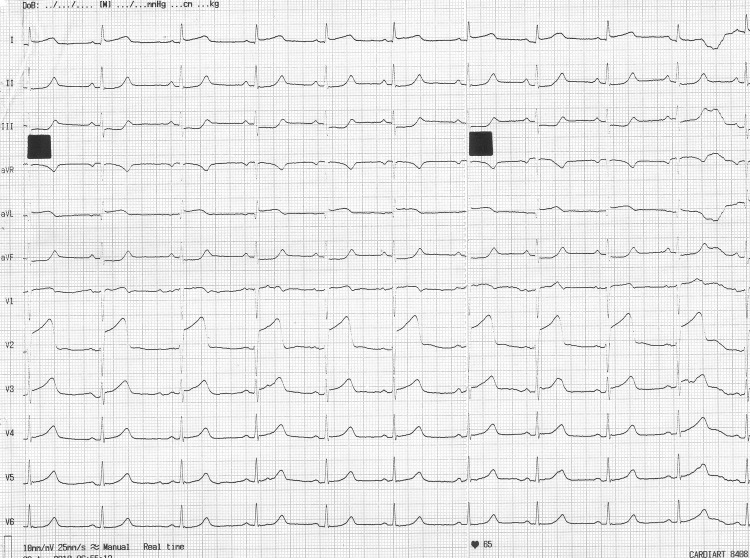 Figure 1