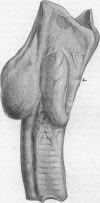 143