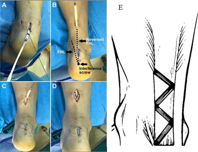 Figure 3.