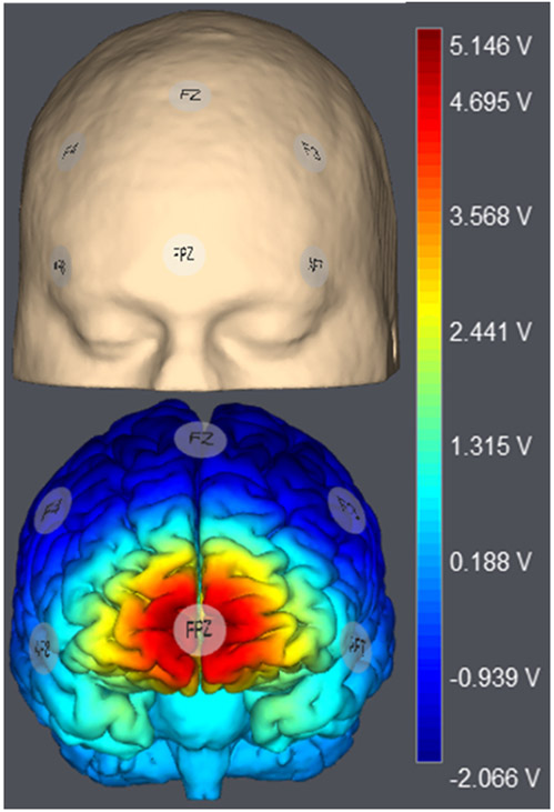 Figure 1.