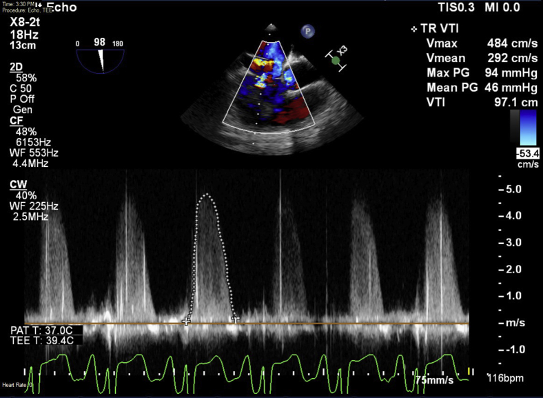 Figure 5