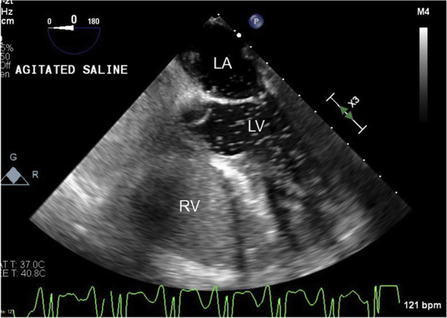 Figure 4