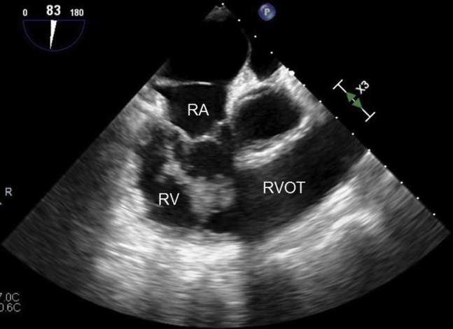 Figure 2