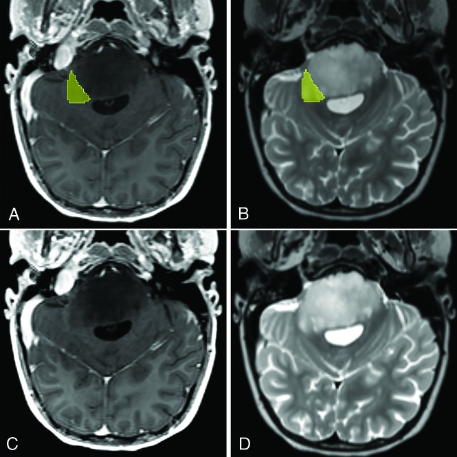 FIG 2.