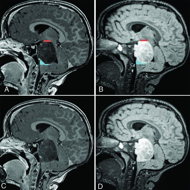 FIG 1.