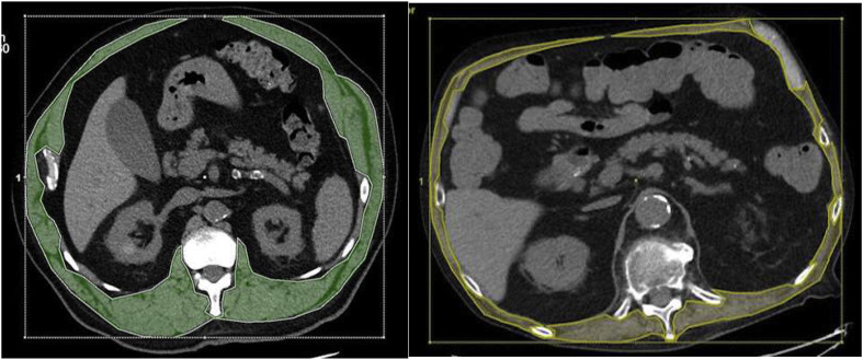 Fig. 1