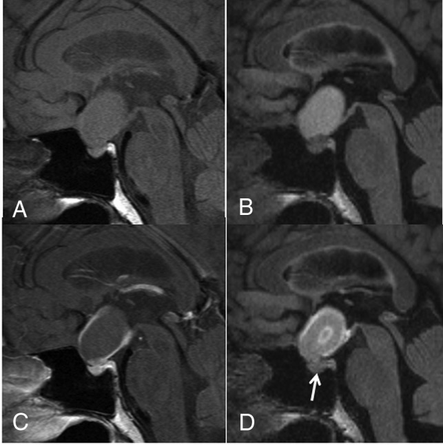 Fig 5.