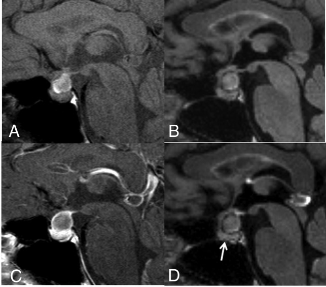 Fig 3.