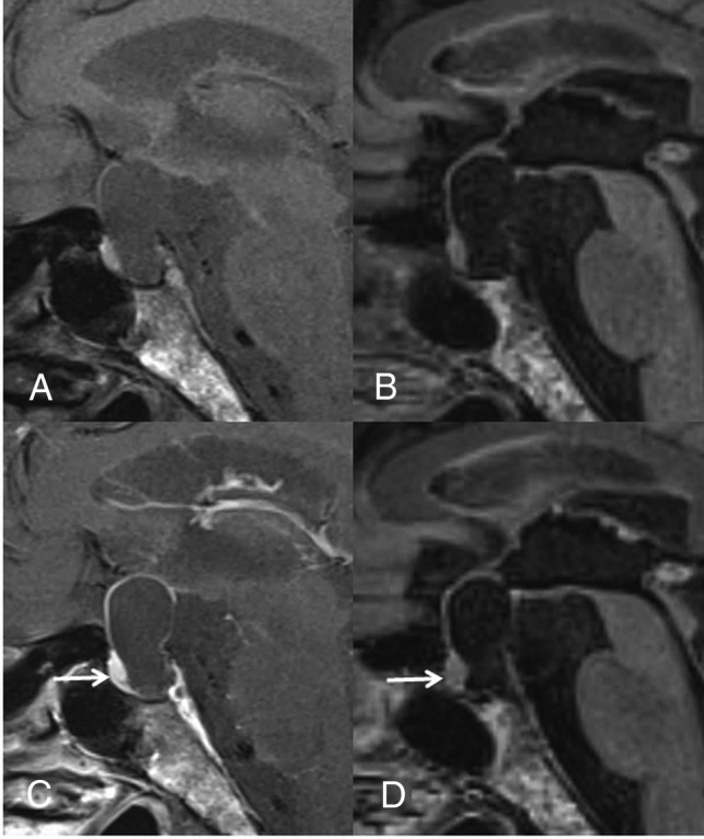 Fig 4.