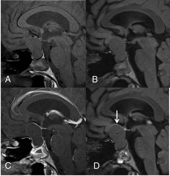 Fig 2.