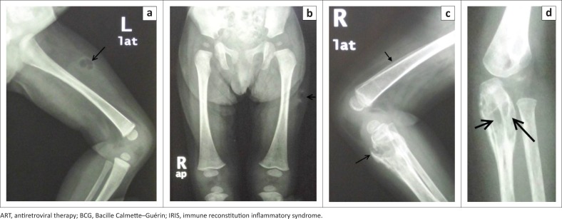 FIGURE 4