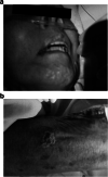 Fig. 1