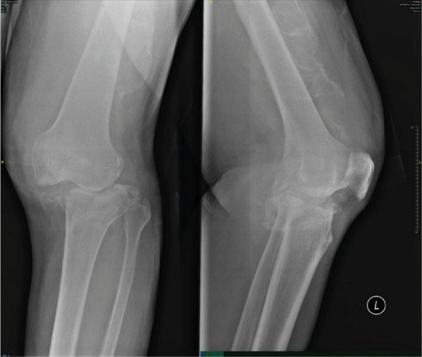 Figure 3-C