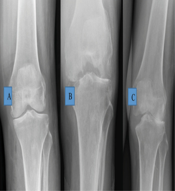 Figure 1-A., Figure 1-B., Figure 1-C.