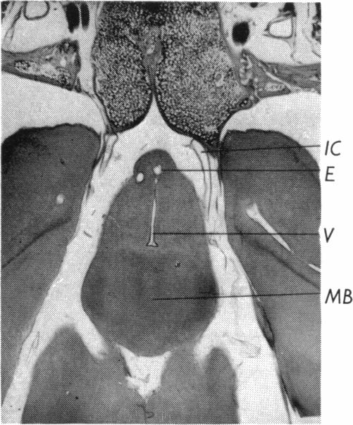 Fig. 11