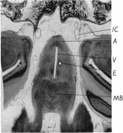 Fig. 17