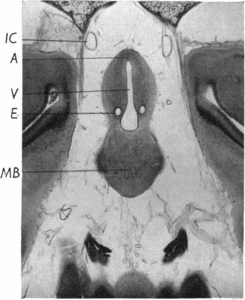 Fig. 18