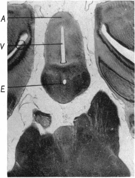 Fig. 14