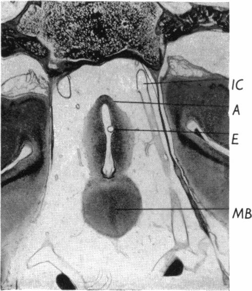 Fig. 13