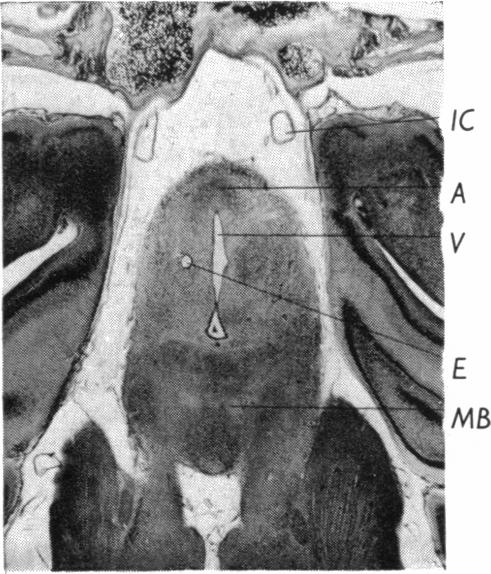 Fig. 19