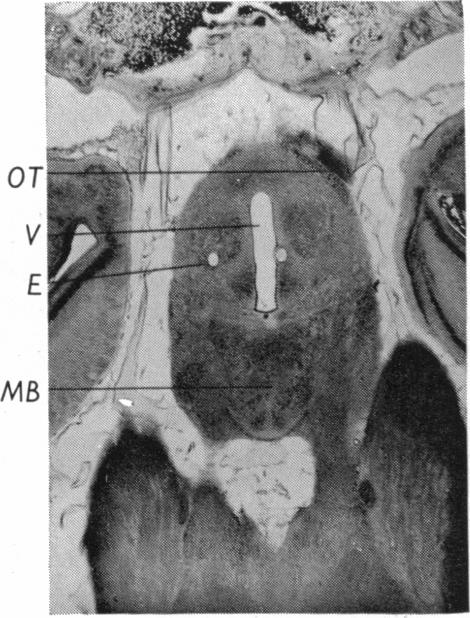 Fig. 16