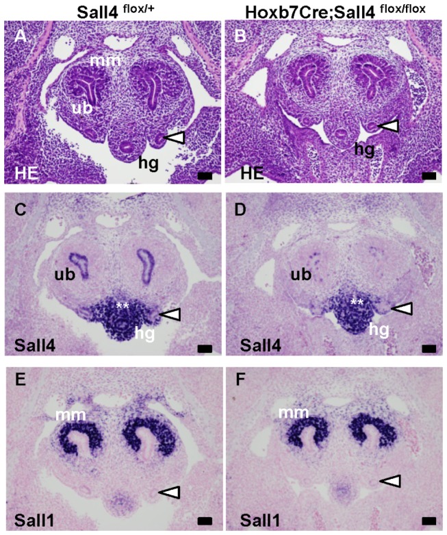 Sall4 Is Transiently Expressed in the Caudal Wolffian Duct and the ...