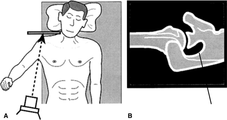 Fig. 1A–B