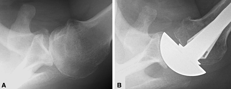 Fig. 4A–B