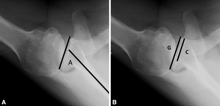 Fig. 3A–B