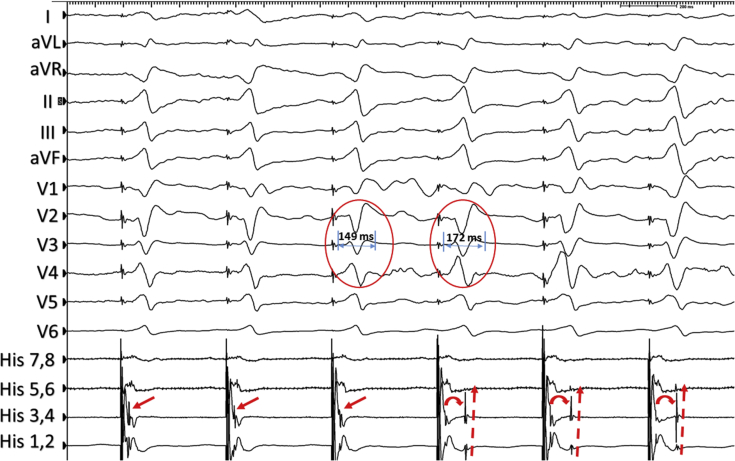 Figure 2