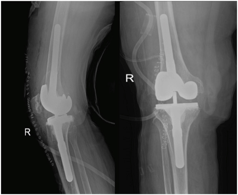 Fig. 3b