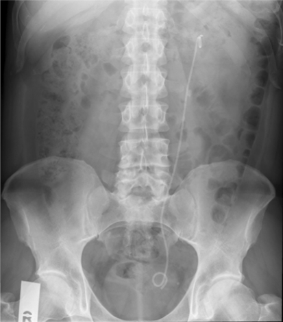 Fig. 1