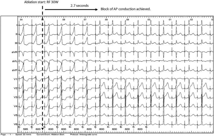 FIGURE 3