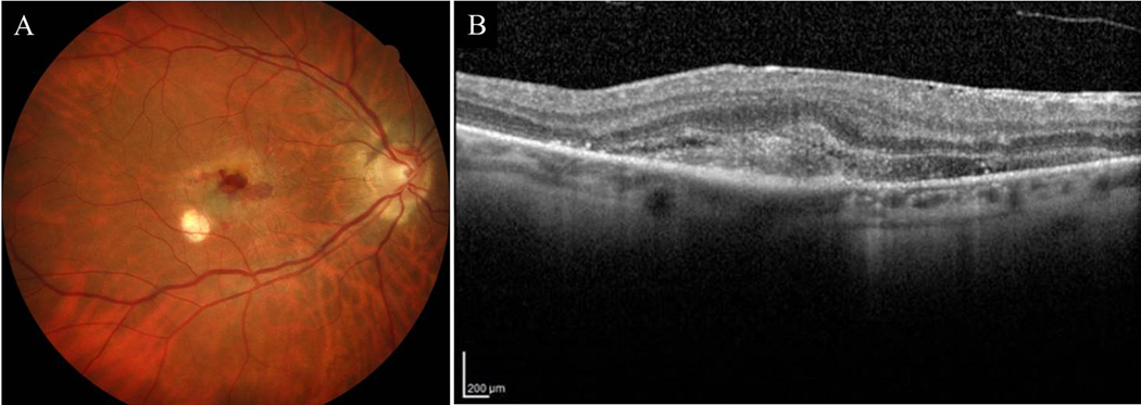 Figure 1A: