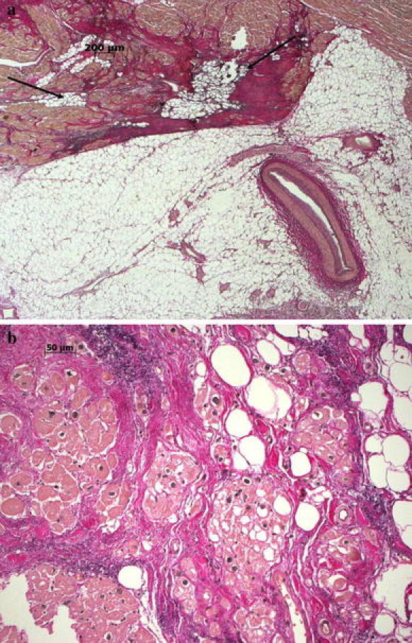 Fig. 4