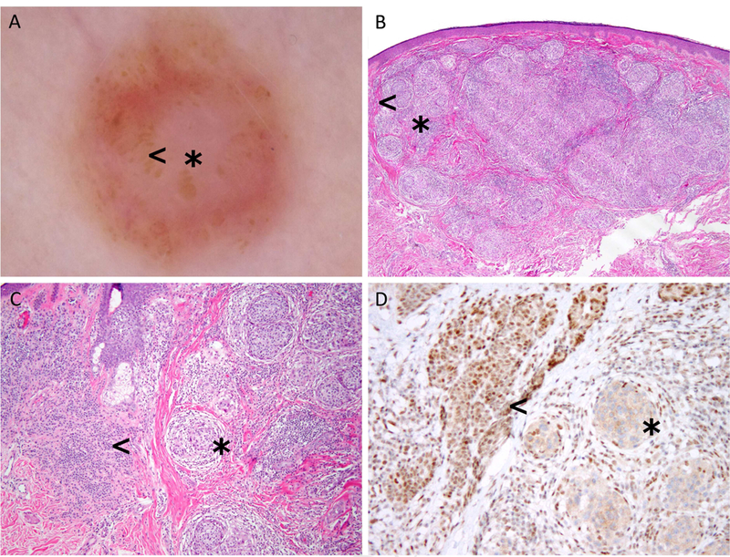 Fig 4.